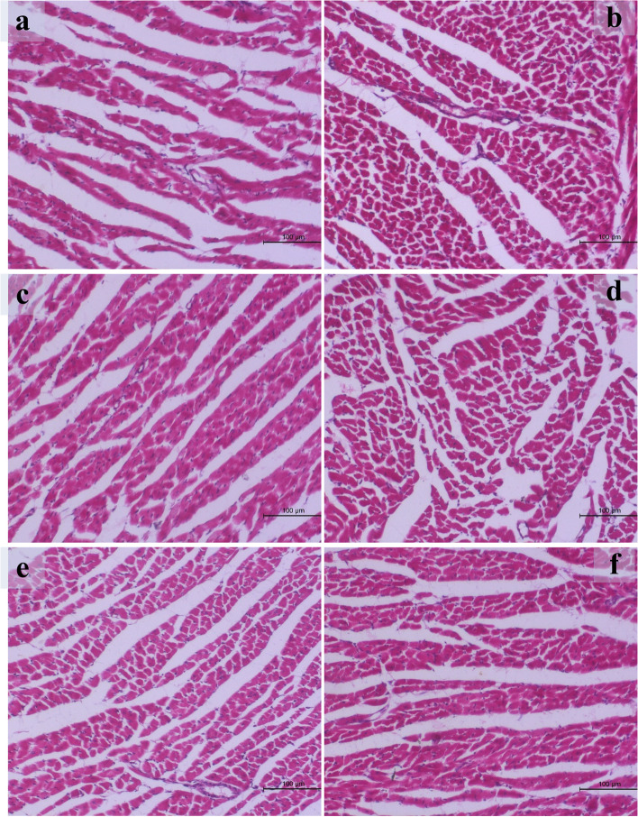 The toxic effects of anabolic steroids "nandrolone decanoate" on cardiac and skeletal muscles with the potential ameliorative effects of silymarin and fenugreek seeds extract in adult male albino rats.