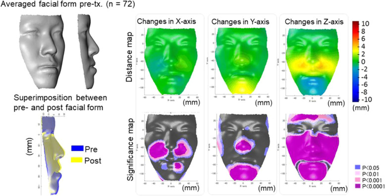 Artificial intelligence applications and ethical challenges in oral and maxillo-facial cosmetic surgery: a narrative review.