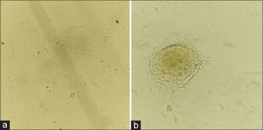 Regeneration of periodontal ligament fibers around mini dental implants and their attachment to the bone in an animal model: A radiographic and histological study.