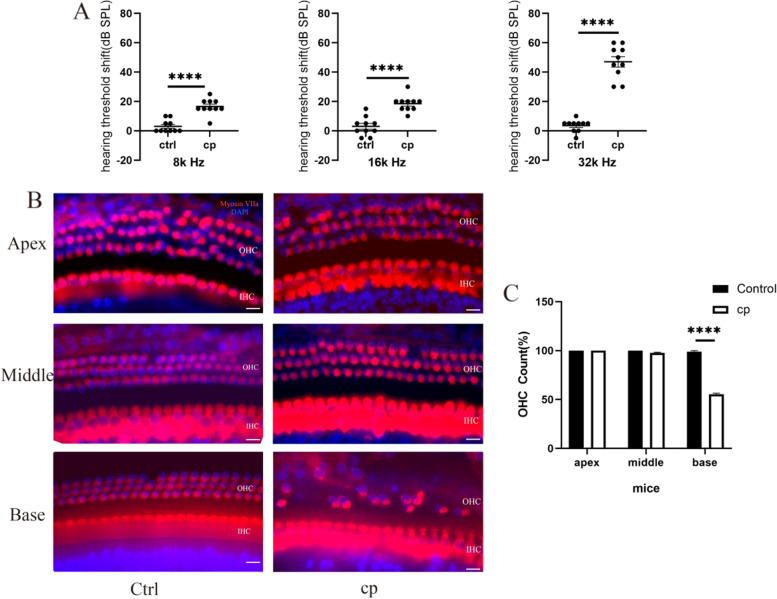 miR-34a/DRP-1-mediated mitophagy participated in cisplatin-induced ototoxicity via increasing oxidative stress.