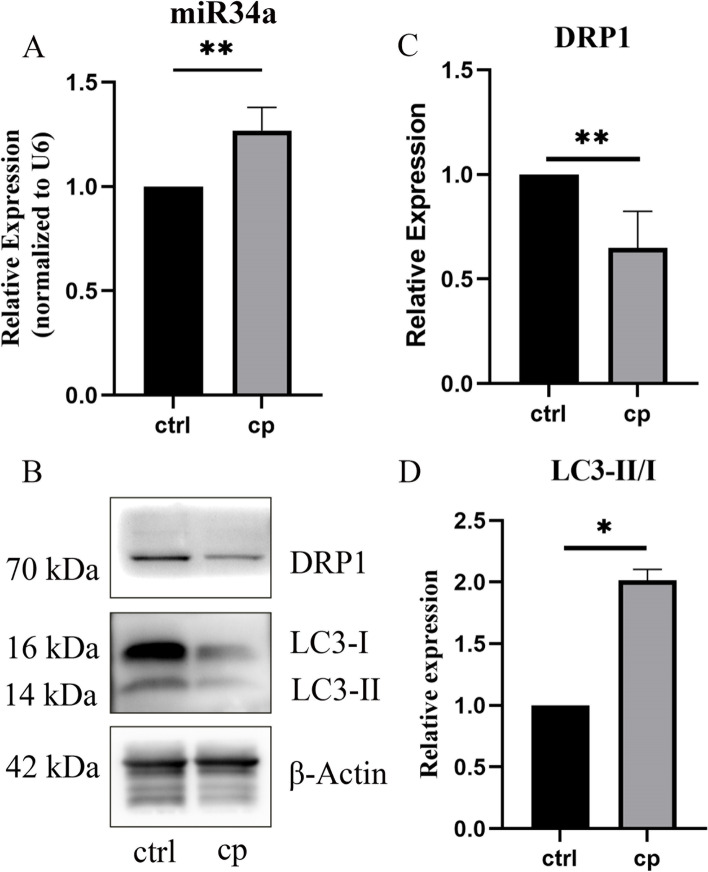 miR-34a/DRP-1-mediated mitophagy participated in cisplatin-induced ototoxicity via increasing oxidative stress.