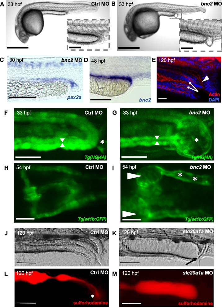 Modelling human lower urinary tract malformations in zebrafish.