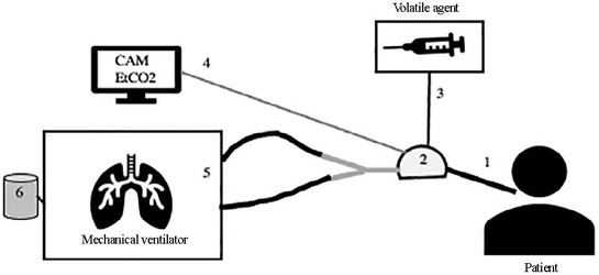 Sedation with volatile anesthetics in the intensive care unit: a new option with old agents.