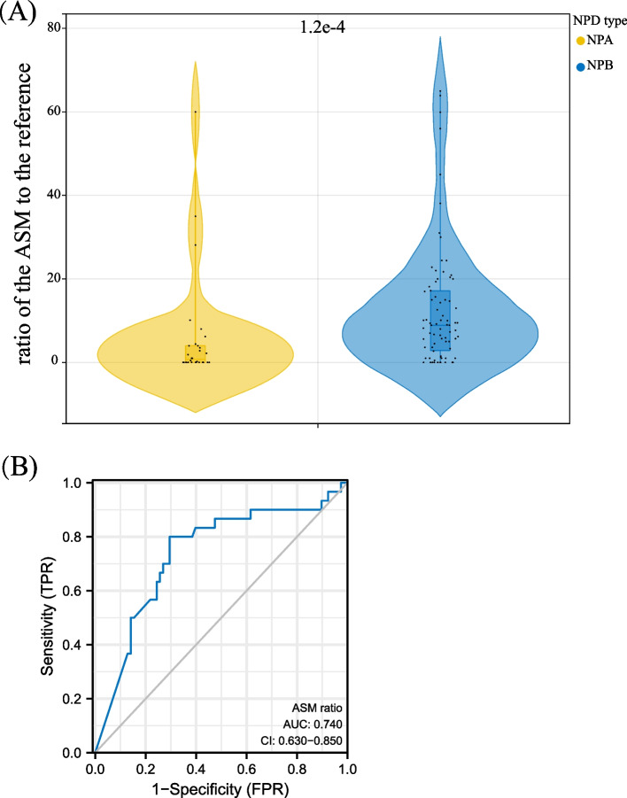 SMPD1 expression profile and mutation landscape help decipher genotype-phenotype association and precision diagnosis for acid sphingomyelinase deficiency.