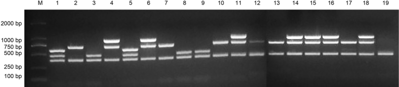 Prevalence and Biological Characteristics of <i>Listeria</i> Species Isolated from Livestock and Poultry Meat in Gansu Province, China.