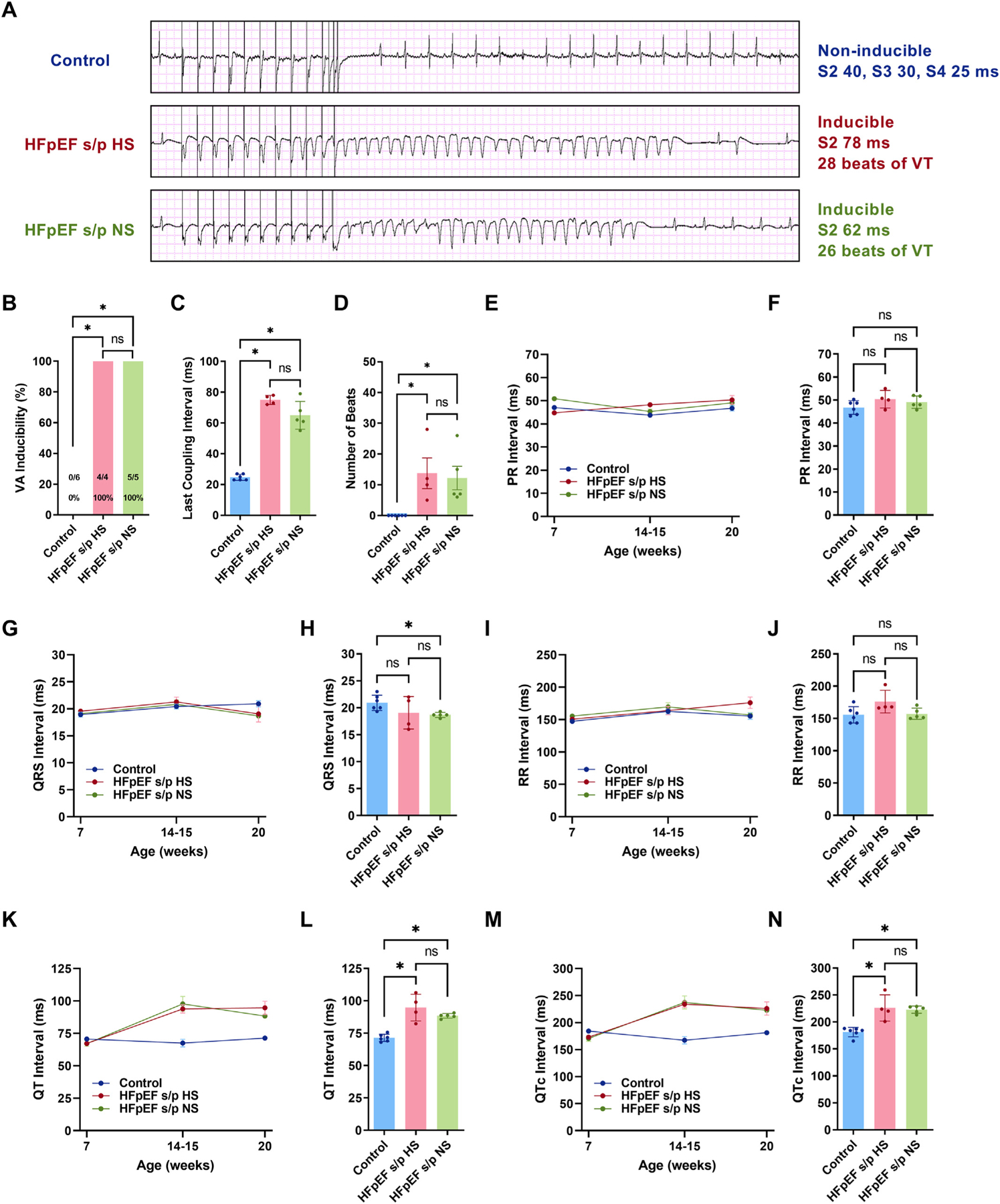 Diet modification reverses diastolic dysfunction in rats with heart failure and preserved ejection fraction