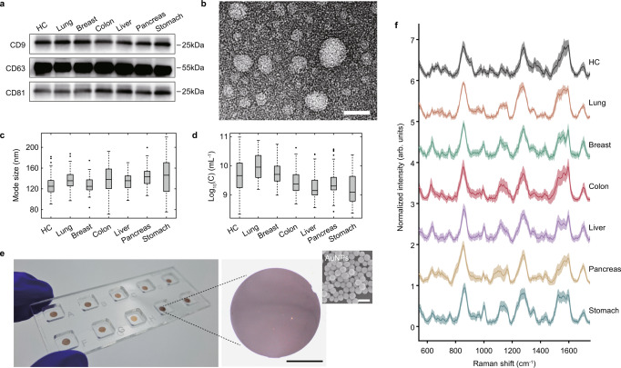 Single test-based diagnosis of multiple cancer types using Exosome-SERS-AI for early stage cancers.