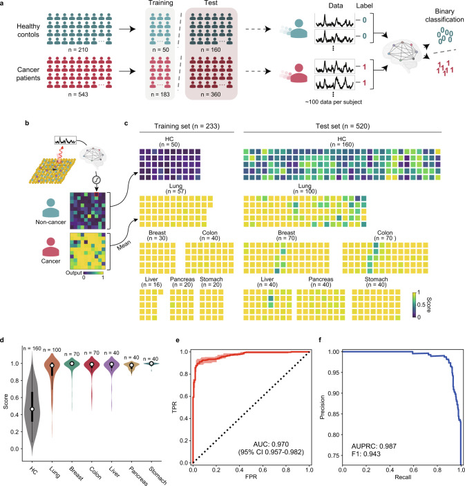 Single test-based diagnosis of multiple cancer types using Exosome-SERS-AI for early stage cancers.