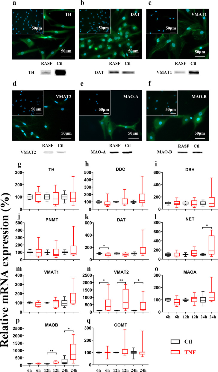 Components of the sympathetic nervous system as targets to modulate inflammation - rheumatoid arthritis synovial fibroblasts as neuron-like cells?