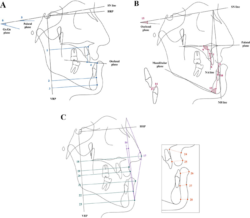 How Similar are the Dentoskeletal Characteristics of Class III Double-Jaw Surgery Patients with Ideal Post-Treatment Profiles and Class I Subjects?