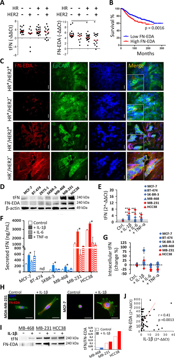 A positive feedback loop driven by fibronectin and IL-1β sustains the inflammatory microenvironment in breast cancer.