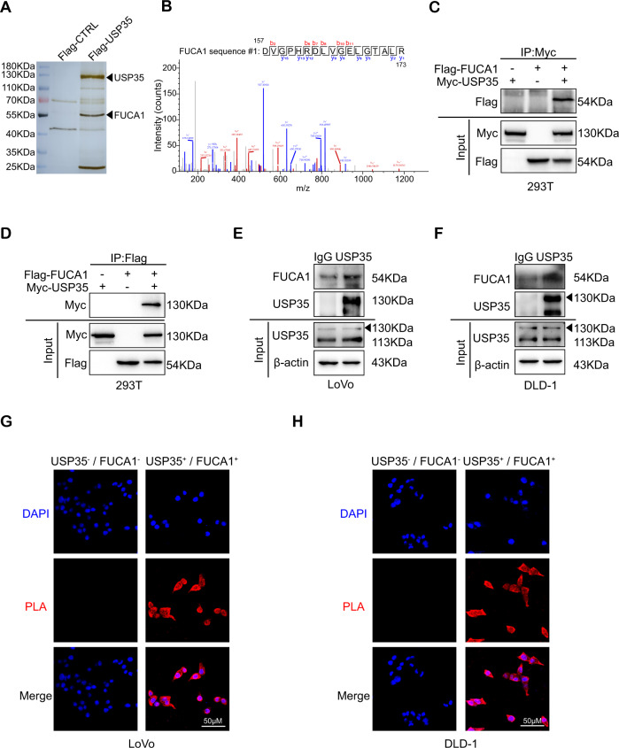 USP35 promotes cell proliferation and chemotherapeutic resistance through stabilizing FUCA1 in colorectal cancer.