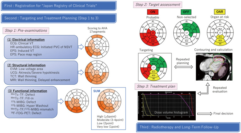 Interim Report of a Japanese Phase II Trial for Cardiac Stereotactic Body Radiotherapy in Refractory Ventricular Tachycardia　- Focus on Target Determination.