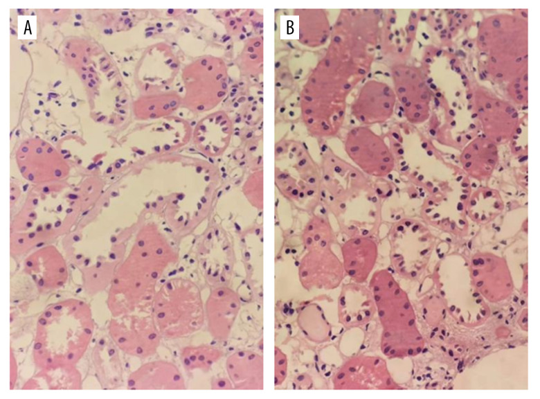 Evaluation and Use of Organs from Donors Poisoned by Organophosphorus Pesticide.