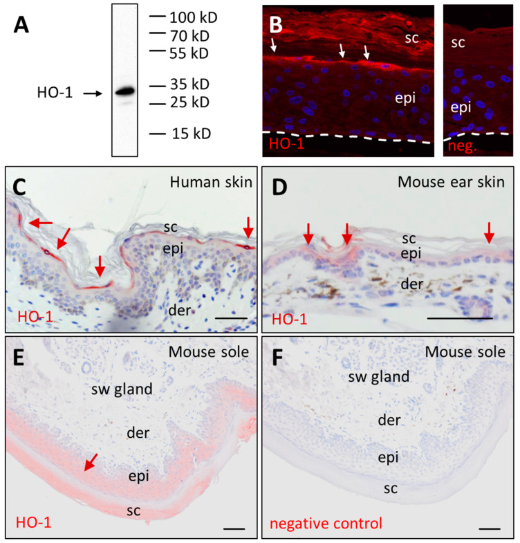 Heme Oxygenase-1 Is Upregulated during Differentiation of Keratinocytes but Its Expression Is Dispensable for Cornification of Murine Epidermis.