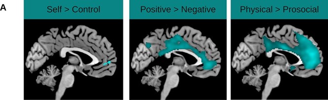 Through the looking glass: the neural basis of self-concept in young adults with antisocial trajectories.