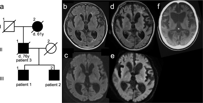 Genetic Creutzfeldt‒Jakob disease with 5-octapeptide repeats presented as frontotemporal dementia.