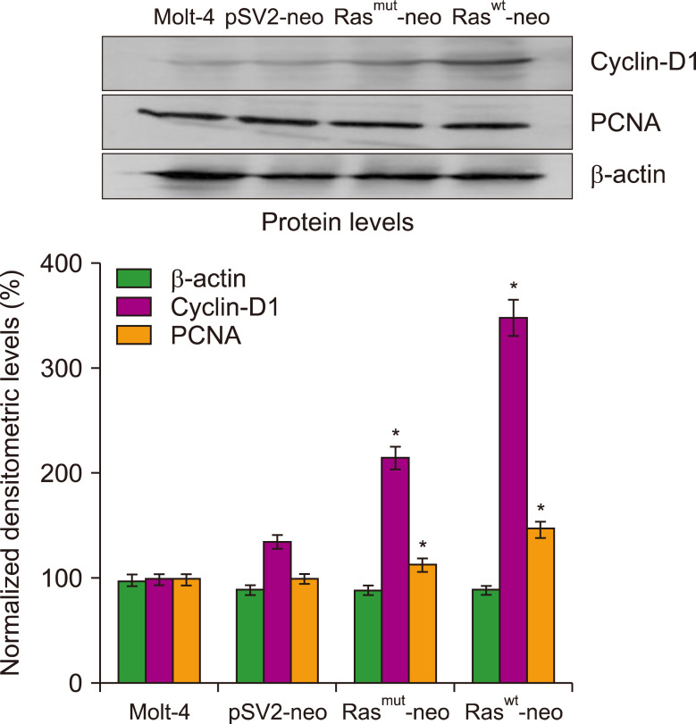 Abnormal expression of <i>H-Ras</i> induces S-phase arrest and mitotic catastrophe in human T-lymphocyte leukemia.