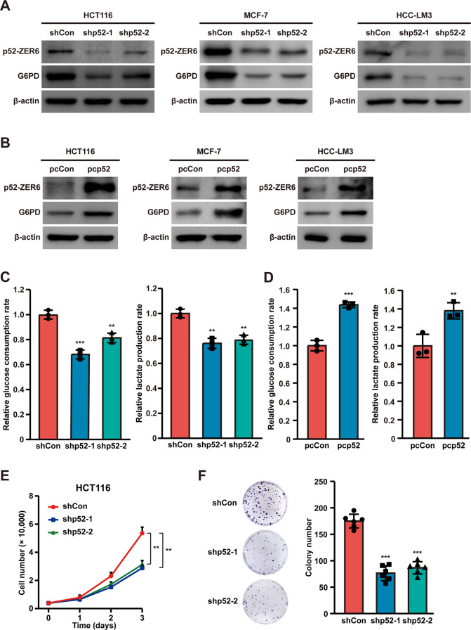 The p52-ZER6/G6PD axis alters aerobic glycolysis and promotes tumor progression by activating the pentose phosphate pathway.