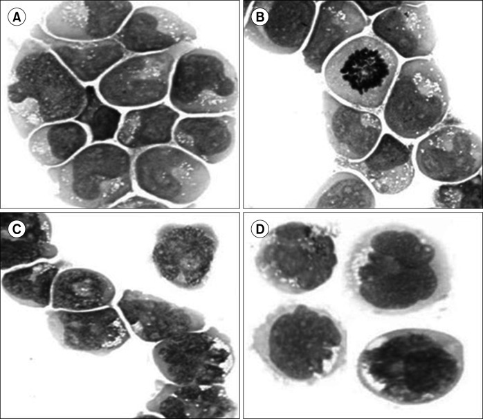 Abnormal expression of <i>H-Ras</i> induces S-phase arrest and mitotic catastrophe in human T-lymphocyte leukemia.