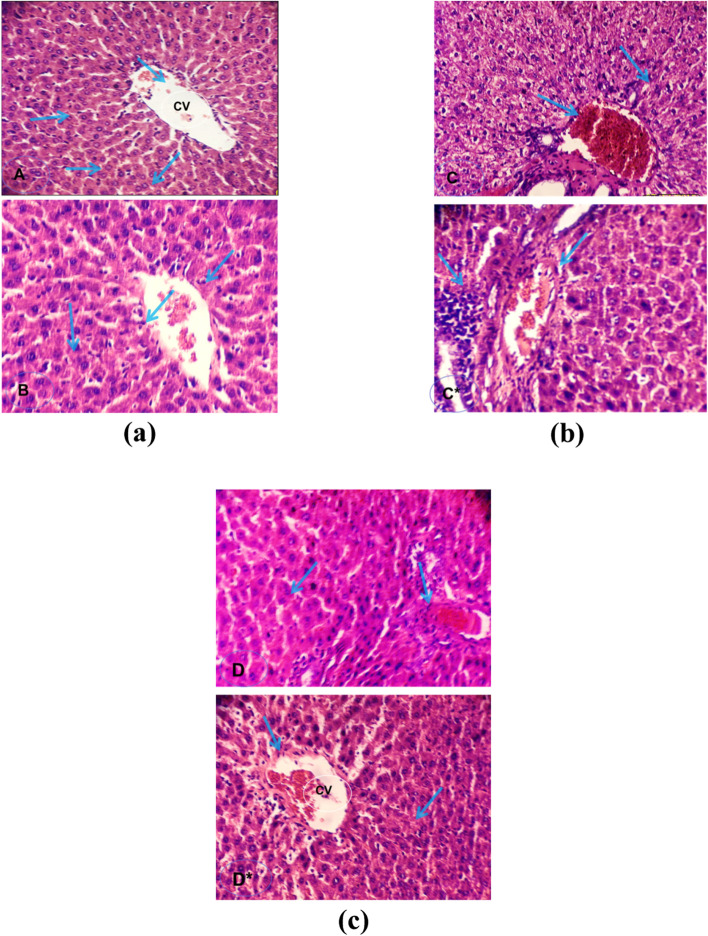 Therapeutic impact of purified Trichoderma viride L-asparaginase in murine model of liver cancer and in vitro Hep-G2 cell line.