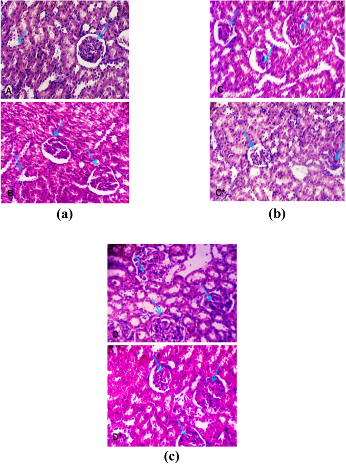 Therapeutic impact of purified Trichoderma viride L-asparaginase in murine model of liver cancer and in vitro Hep-G2 cell line.