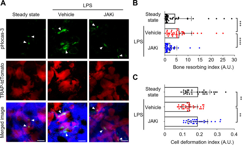 JAK inhibition ameliorates bone destruction by simultaneously targeting mature osteoclasts and their precursors.