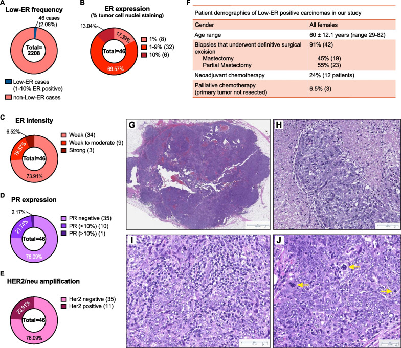 Lineage plasticity enables low-ER luminal tumors to evolve and gain basal-like traits.