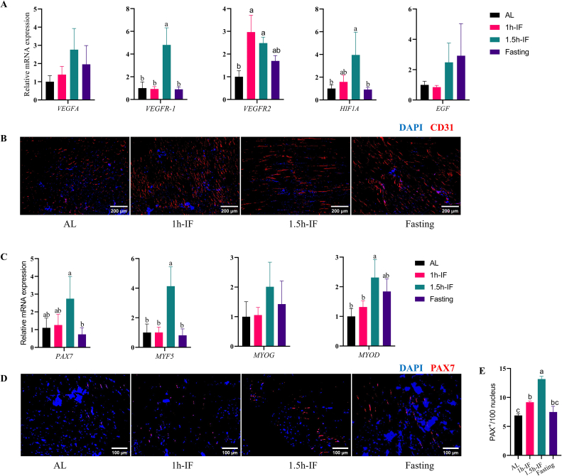 Restricted feeding regimens improve white striping associated muscular defects in broiler chickens