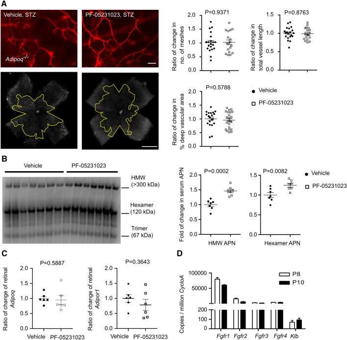 FGF21 via mitochondrial lipid oxidation promotes physiological vascularization in a mouse model of Phase I ROP