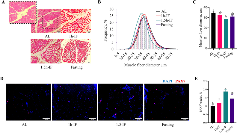 Restricted feeding regimens improve white striping associated muscular defects in broiler chickens