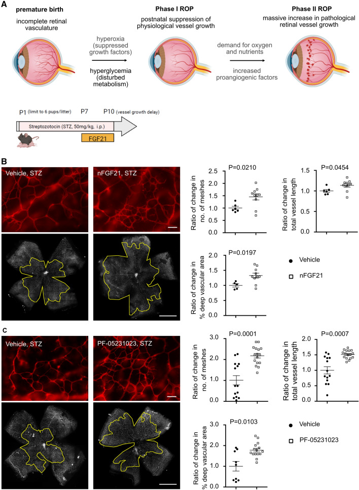 FGF21 via mitochondrial lipid oxidation promotes physiological vascularization in a mouse model of Phase I ROP