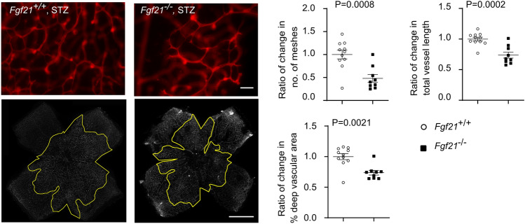 FGF21 via mitochondrial lipid oxidation promotes physiological vascularization in a mouse model of Phase I ROP