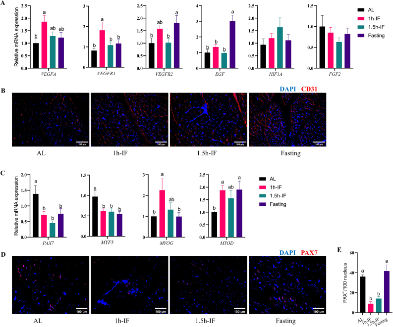 Restricted feeding regimens improve white striping associated muscular defects in broiler chickens