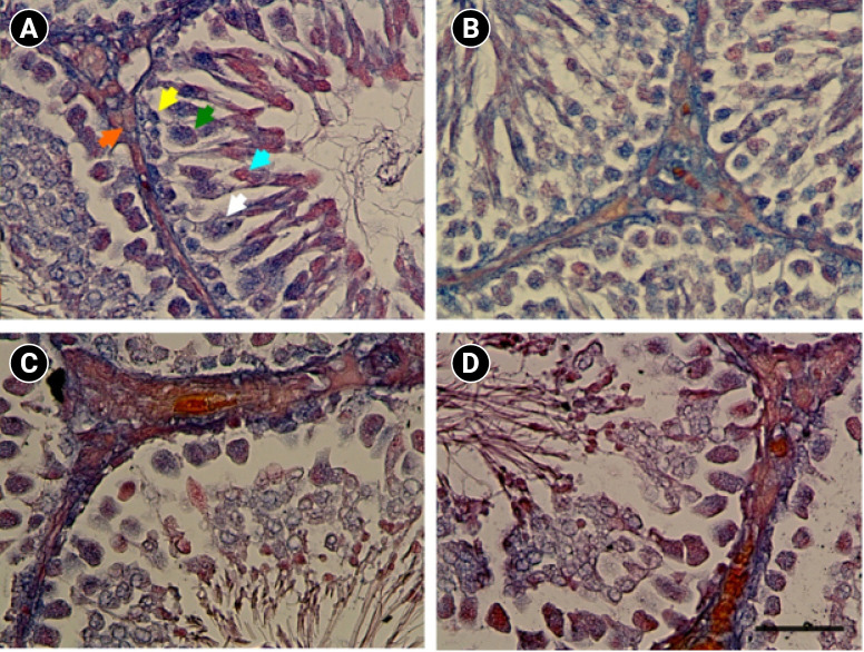 Sleep deprivation induces structural changes in the adult rat testis: The protective effects of olive oil.