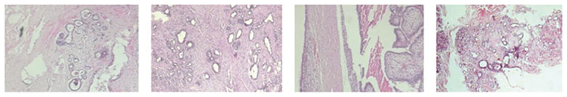 A Survey of Convolutional Neural Network in Breast Cancer.