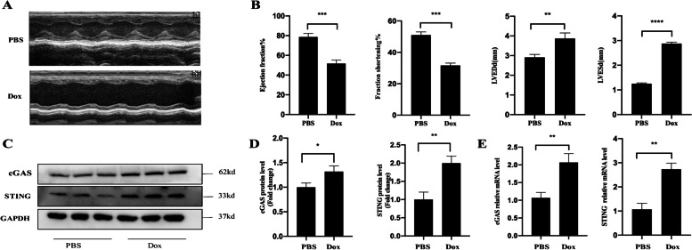 GAS-STING signaling plays an essential pathogenetic role in Doxorubicin-Induced Cardiotoxicity.