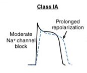 Arrhythmias After Acute Myocardial Infarction.