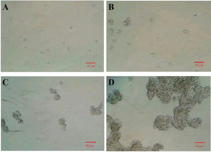 Effect of Mir-4270 Inhibitor and Mimic on Viability and Stemness in Gastric Cancer Stem-Like Cells Derived from MKN-45 Cell Line.