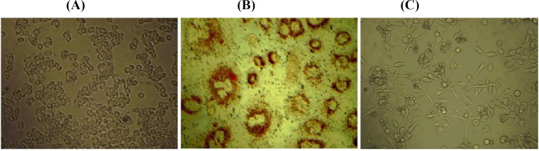 Effect of Mir-4270 Inhibitor and Mimic on Viability and Stemness in Gastric Cancer Stem-Like Cells Derived from MKN-45 Cell Line.