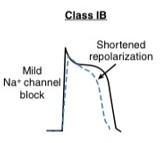 Arrhythmias After Acute Myocardial Infarction.