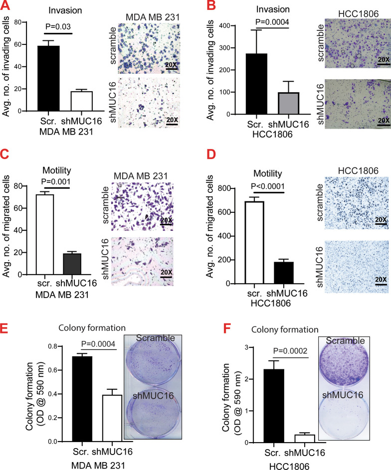 MUC16 promotes triple-negative breast cancer lung metastasis by modulating RNA-binding protein ELAVL1/HUR.