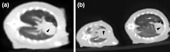 Effects of amifostine against blunt chest trauma-induced cardiac injury in rats.