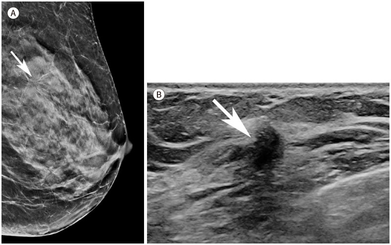 [Interpretation of Image-Guided Biopsy Results and Assessment].