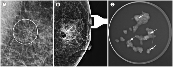 [Interpretation of Image-Guided Biopsy Results and Assessment].