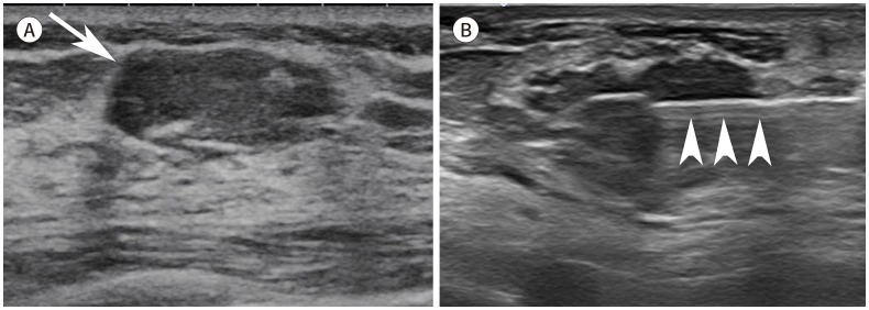 [Interpretation of Image-Guided Biopsy Results and Assessment].