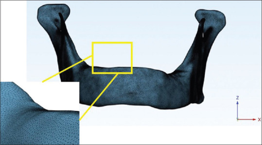 Comparison between all-on-four and all-on-six treatment concepts on stress distribution for full-mouth rehabilitation using three-dimensional finite element analysis: A biomechanical study.