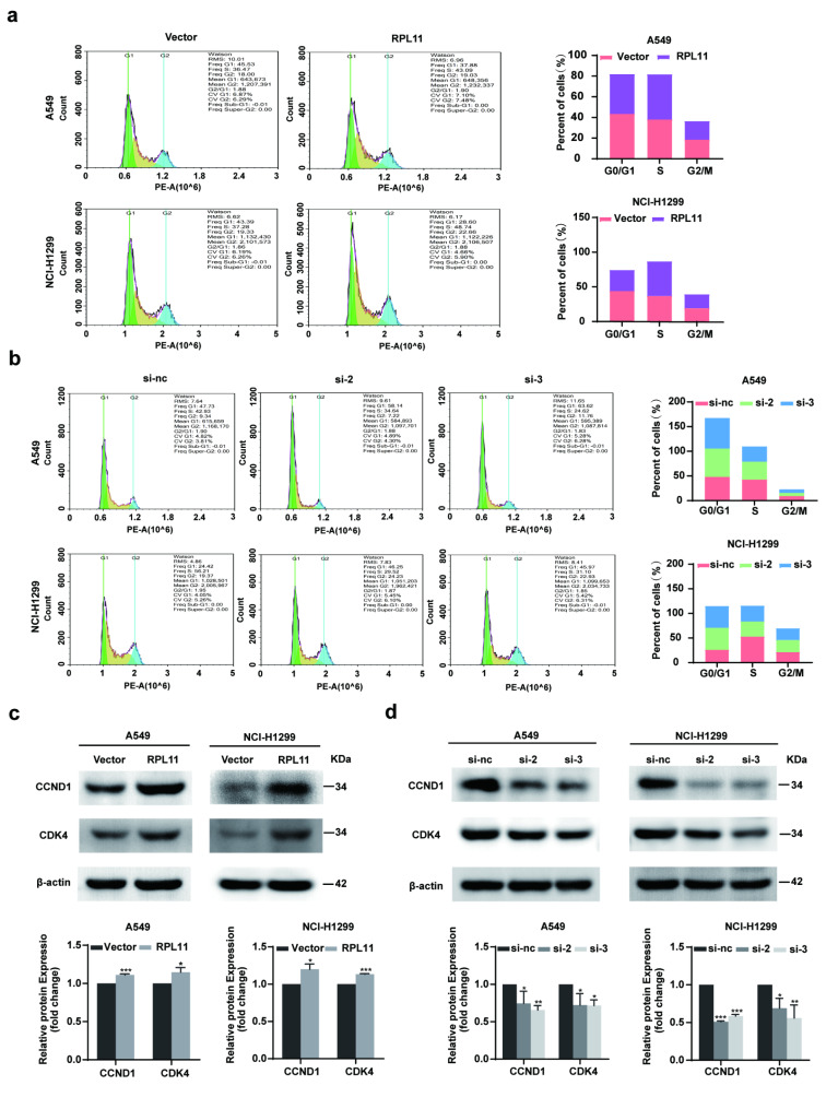 RPL11 promotes non-small cell lung cancer cell proliferation by regulating endoplasmic reticulum stress and cell autophagy.