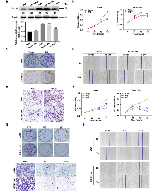 RPL11 promotes non-small cell lung cancer cell proliferation by regulating endoplasmic reticulum stress and cell autophagy.