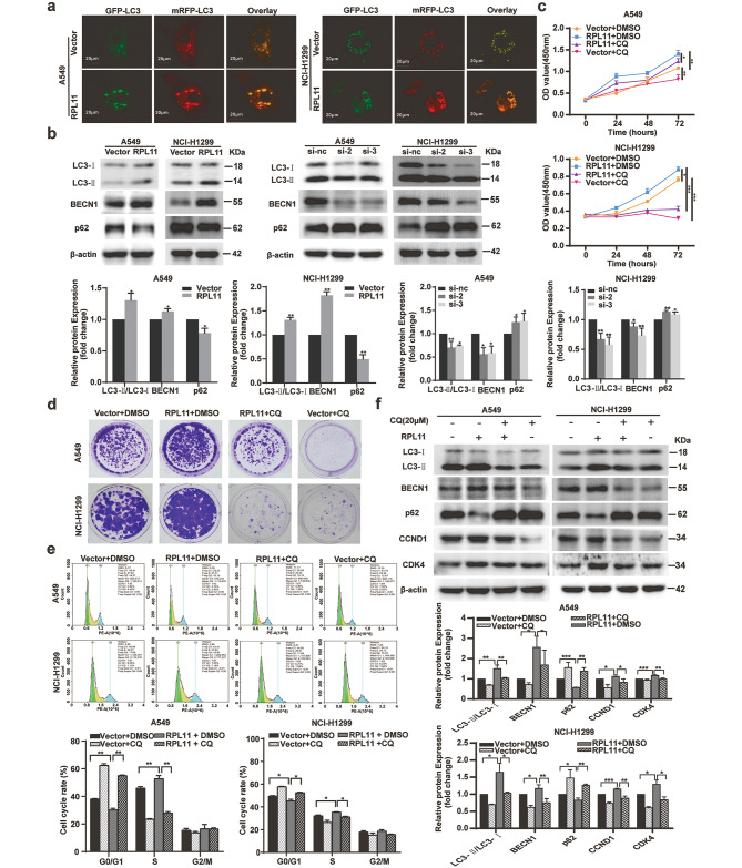 RPL11 promotes non-small cell lung cancer cell proliferation by regulating endoplasmic reticulum stress and cell autophagy.